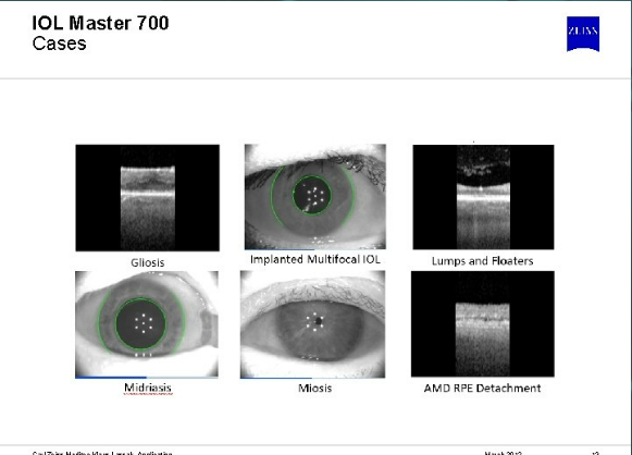 biometria ocular 2