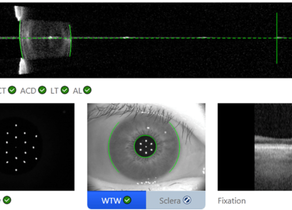 biometria ocular 3