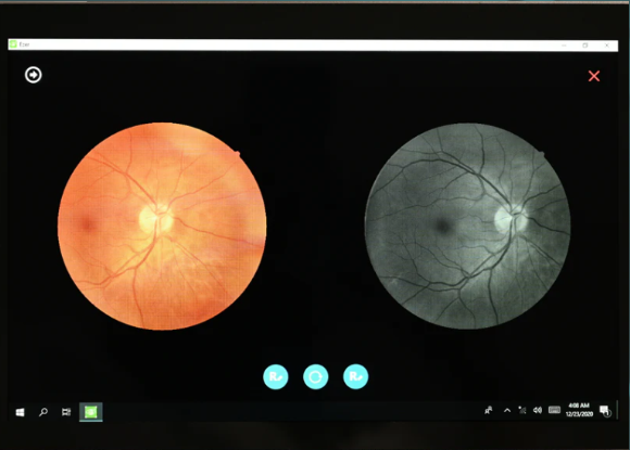 Camara de fondo de ojo (2)