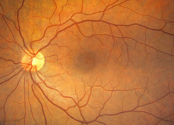 Camara de fondo de ojo (3)
