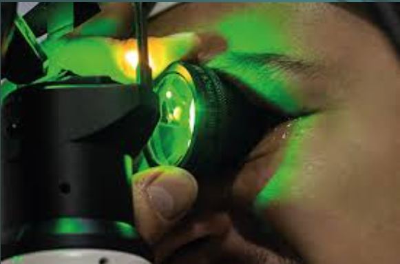 laser argon (2)