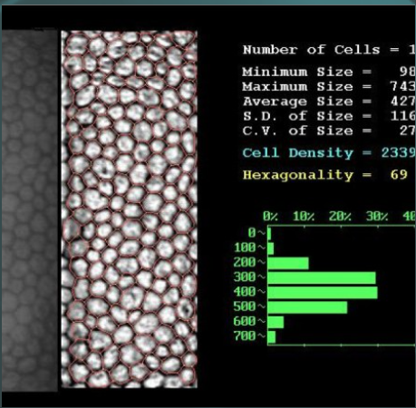 microscopia especular (2)