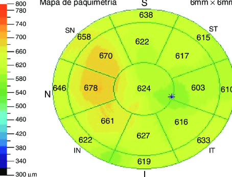 paquimetria (2)